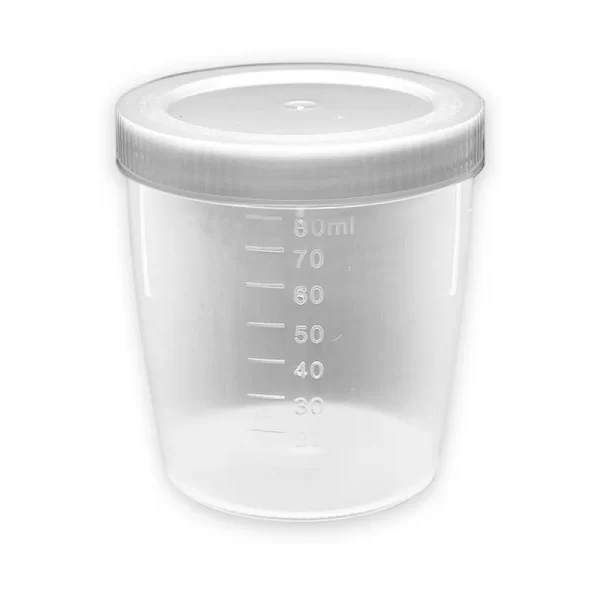 Coletor Universal Tampa Branca 80 ml C/100 Unidades  - J Prolab